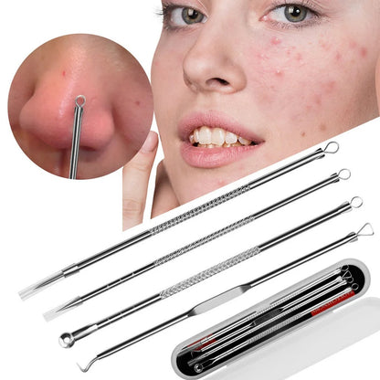 Acne Needle & Blackhead Remover Set (4pcs)