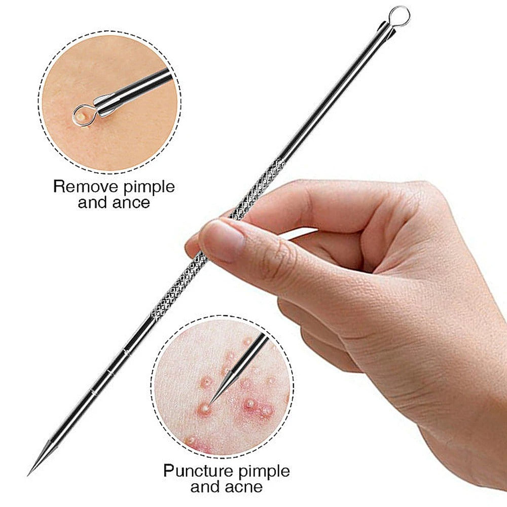 Acne Needle & Blackhead Remover Set (4pcs)